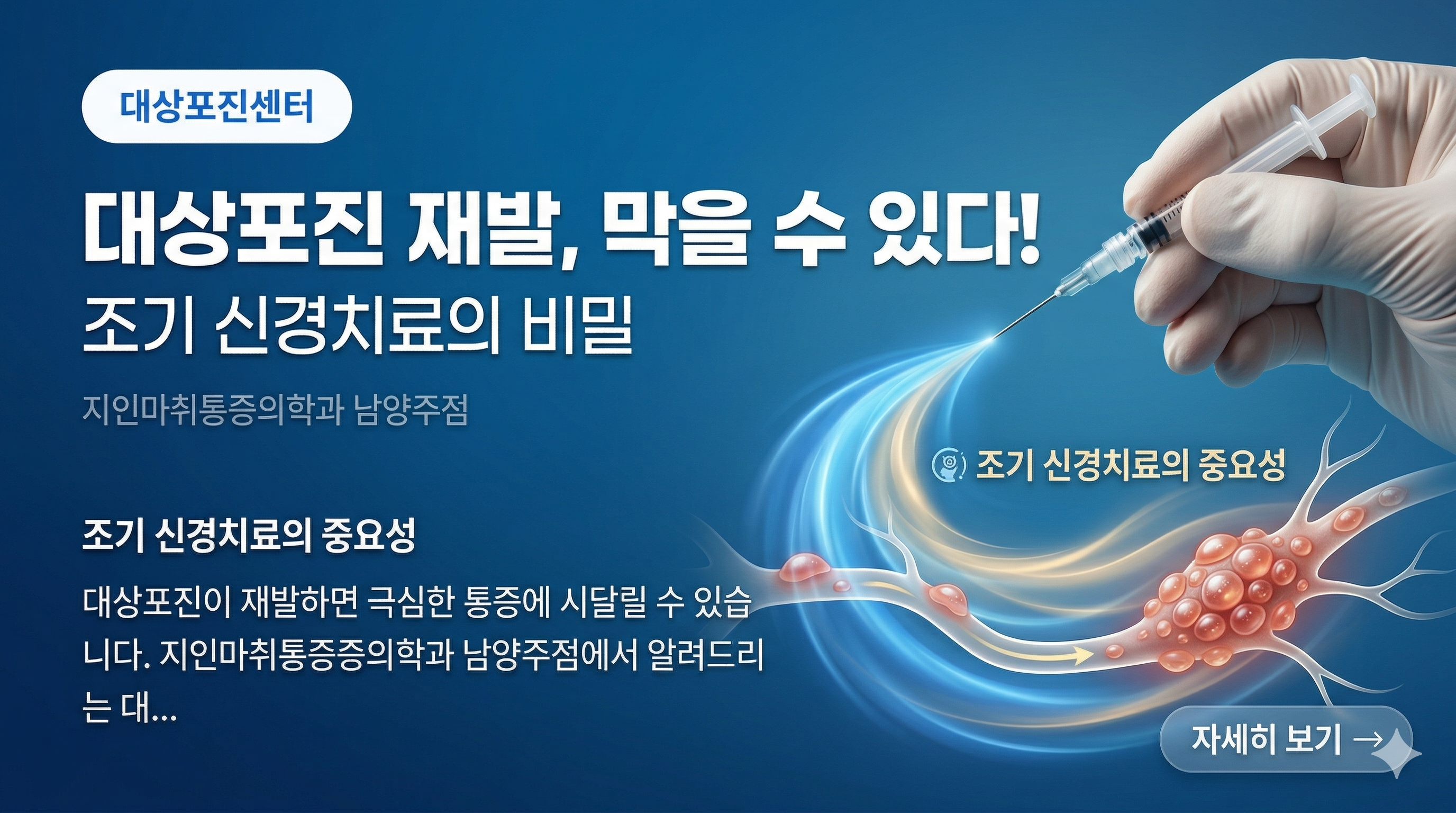대상포진 재발 막는 비밀 - 조기 신경치료의 중요성